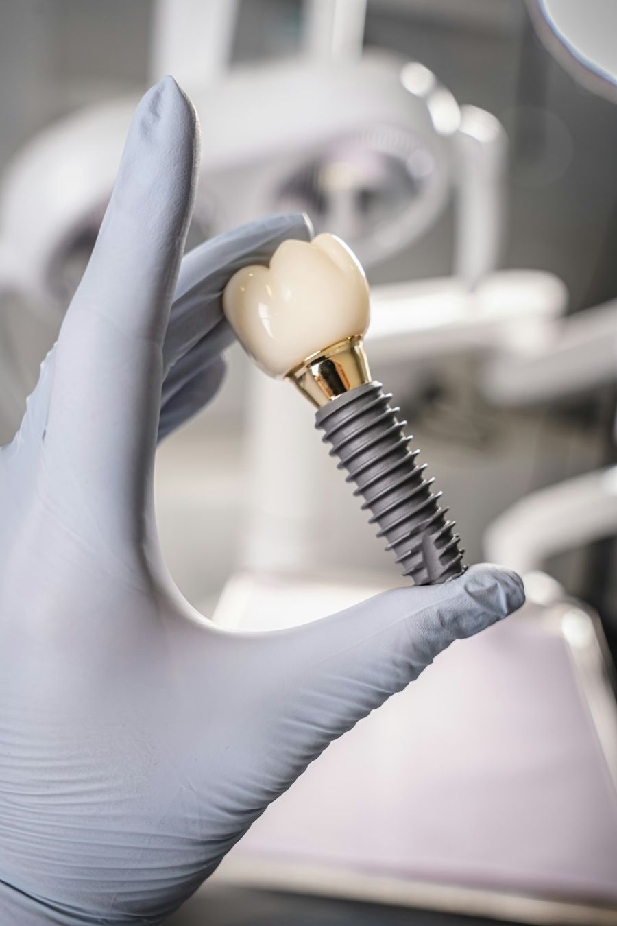 Modelo de implante dental