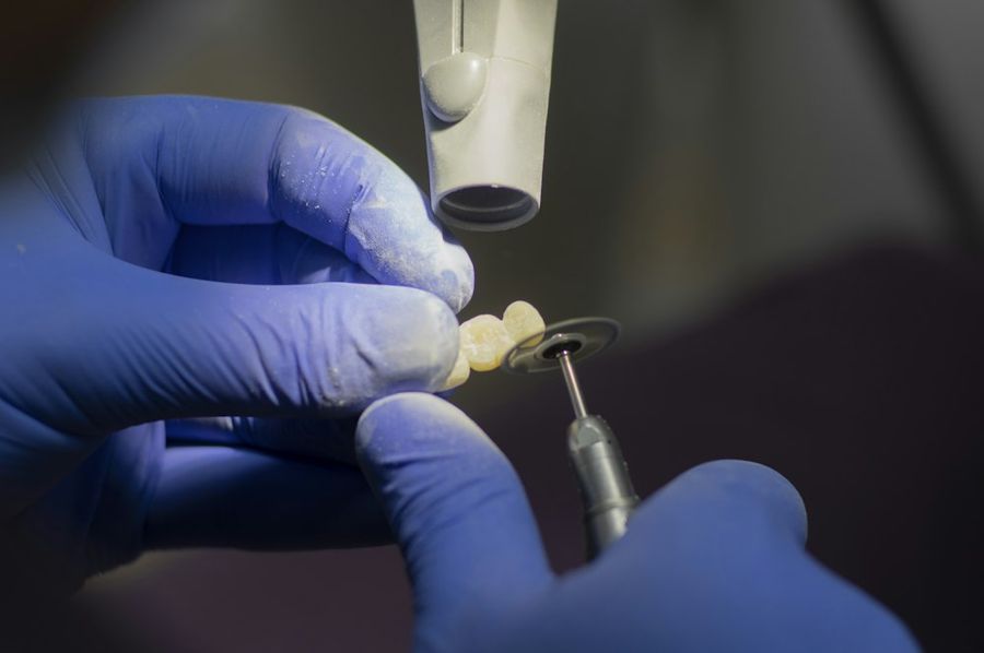 Odontólogo trabajando una corona dental